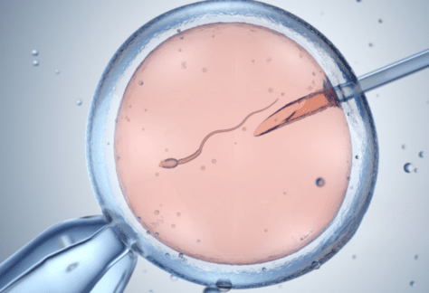 Infertility and Surrogacy